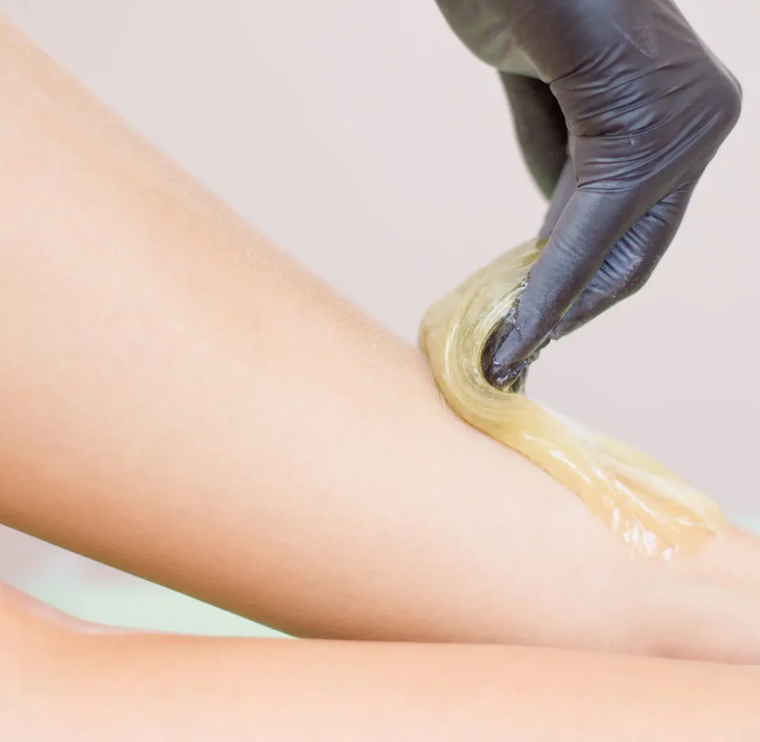 procedure of hair removing on leg beautiful woman with sugar paste or wax honey and black gloves hand – depilation and beauty concept Sokerointi